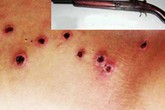 Dùng súng hoa cải thanh toán đối thủ trong đêm khuya Dùng súng hoa cải thanh toán đối thủ trong đêm khuya