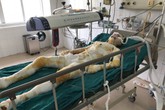 Sự sống mong manh của 2 cô gái bị biến thành “đuốc sống” Sự sống mong manh của 2 cô gái bị biến thành “đuốc sống”