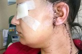 Phát hiện vết sưng nhỏ trên mặt trước khi sinh, người mẹ trẻ đâu ngờ sau 2 tuần lại trở thành khối u ác tính và cô mắc bệnh ung thư giai đoạn cuối Phát hiện vết sưng nhỏ trên mặt trước khi sinh, người mẹ trẻ đâu ngờ sau 2 tuần lại trở thành khối u ác tính và cô mắc bệnh ung thư giai đoạn cuối