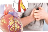 Béo phì – kẻ thù làm trái tim suy yếu Béo phì – kẻ thù làm trái tim suy yếu