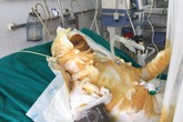 Gia đình 3 người bỏng nặng vì cháy nhà, hai người đã qua đời Gia đình 3 người bỏng nặng vì cháy nhà, hai người đã qua đời