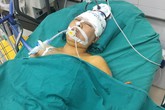Đi mua cơm chăm chồng, người phụ nữ bị xe đâm chấn thương sọ não Đi mua cơm chăm chồng, người phụ nữ bị xe đâm chấn thương sọ não