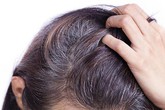 Đau đầu về tóc bạc sớm và đây là cách chuyên gia khuyên bạn Đau đầu về tóc bạc sớm và đây là cách chuyên gia khuyên bạn