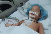 Bé gái 4 tuổi bị bút bi đâm xuyên ngực Bé gái 4 tuổi bị bút bi đâm xuyên ngực