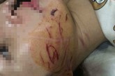 Thông tin mới nhất về sức khỏe cô gái bị lột đồ, đổ nước mắm, bôi ớt lên người ở Thanh Hóa Thông tin mới nhất về sức khỏe cô gái bị lột đồ, đổ nước mắm, bôi ớt lên người ở Thanh Hóa