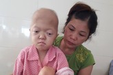 Xót xa bé gái tàn tật lại mắc bệnh ung thư Xót xa bé gái tàn tật lại mắc bệnh ung thư