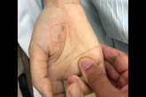 Hà Nội: Một nữ bác sĩ thú y trẻ tuổi tử vong vì chó ốm cắn vào tay Hà Nội: Một nữ bác sĩ thú y trẻ tuổi tử vong vì chó ốm cắn vào tay