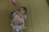 Tương lai chồng chất khó khăn của cô bé 5 tuổi mang đa dị tật bẩm sinh Tương lai chồng chất khó khăn của cô bé 5 tuổi mang đa dị tật bẩm sinh