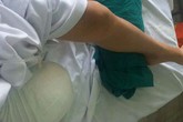 Cắt bỏ chân phải khi uống thuốc tim mạch không đều Cắt bỏ chân phải khi uống thuốc tim mạch không đều