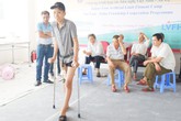 Ước mơ chân giả của cậu bé cụt chân vì ung thư xương thành hiện thực Ước mơ chân giả của cậu bé cụt chân vì ung thư xương thành hiện thực