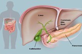 6 dấu hiệu đã đến lúc bạn cần thải độc gan 6 dấu hiệu đã đến lúc bạn cần thải độc gan