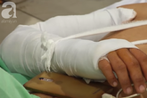 Đang nằm trong bệnh viện, người đàn ông bất ngờ dùng kéo đâm 5 nhát vào tim mình Đang nằm trong bệnh viện, người đàn ông bất ngờ dùng kéo đâm 5 nhát vào tim mình