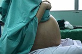 Cô gái 20 tuổi chết lặng khi biết "thủ phạm" khiến bụng to hơn thai phụ sắp sinh Cô gái 20 tuổi chết lặng khi biết "thủ phạm" khiến bụng to hơn thai phụ sắp sinh