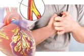Chuyên gia chỉ rõ những thói quen giúp người trẻ tránh xa bệnh tim mạch Chuyên gia chỉ rõ những thói quen giúp người trẻ tránh xa bệnh tim mạch