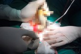 Nam thanh niên bị vòi hoa sen chui vào hậu môn vì thói quen dùng vòi xịt sau đại tiện Nam thanh niên bị vòi hoa sen chui vào hậu môn vì thói quen dùng vòi xịt sau đại tiện