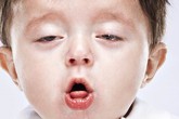 Từ vụ mất mạng vì hút trà sữa chân châu, bác sỹ nói thêm về những cái chết oan vì bị sặc Từ vụ mất mạng vì hút trà sữa chân châu, bác sỹ nói thêm về những cái chết oan vì bị sặc