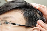 Cách trị tóc bạc sớm Cách trị tóc bạc sớm