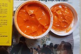 Ngứa, rát, đỏ da sau khi dùng kem tan mỡ Ngứa, rát, đỏ da sau khi dùng kem tan mỡ