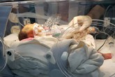 Bé sinh non 1,1 kg có ruột nằm trong lồng ngực Bé sinh non 1,1 kg có ruột nằm trong lồng ngực