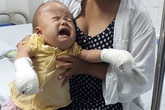 Tiếng khóc xé lòng của bé 17 tháng tuổi bị dị dạng Tiếng khóc xé lòng của bé 17 tháng tuổi bị dị dạng