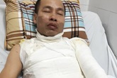 Hà Nội: Bố bị tạt a-xít, con 9 tuổi gào khóc trong xe Hà Nội: Bố bị tạt a-xít, con 9 tuổi gào khóc trong xe