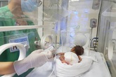 Chuyên gia chỉ rõ những sai lầm của mẹ khi chăm sóc con sinh non tháng Chuyên gia chỉ rõ những sai lầm của mẹ khi chăm sóc con sinh non tháng