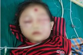 Bé gái 6 tuổi ở Phú Thọ suýt mất mạng chỉ vì nốt mụn nhỏ trên mặt Bé gái 6 tuổi ở Phú Thọ suýt mất mạng chỉ vì nốt mụn nhỏ trên mặt