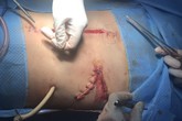 Kích hoạt báo động đỏ nội viện cứu sống bệnh nhân chịu hàng chục chấn thương nguy kịch Kích hoạt báo động đỏ nội viện cứu sống bệnh nhân chịu hàng chục chấn thương nguy kịch