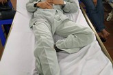 Tài xế xe con bị chém vỡ đầu sau va chạm giao thông Tài xế xe con bị chém vỡ đầu sau va chạm giao thông