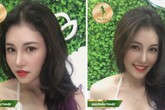 Cơn sốt nâng mũi Sform tại TMV Sài Gòn Venus Cơn sốt nâng mũi Sform tại TMV Sài Gòn Venus