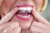 Cẩn trọng làm đẹp “cấp tốc” đón Tết bằng miếng dán làm trắng răng Cẩn trọng làm đẹp “cấp tốc” đón Tết bằng miếng dán làm trắng răng