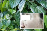 Gặp họa vì làm đẹp da mặt đón Tết bằng đắp lá trầu không Gặp họa vì làm đẹp da mặt đón Tết bằng đắp lá trầu không