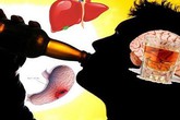Quý ông Việt uống rượu, bia thuộc nhóm cao nhất thế giới Quý ông Việt uống rượu, bia thuộc nhóm cao nhất thế giới