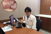 Bác sĩ hãi hùng khi thấy miệng bệnh nhân mốc trắng từng mảng, biết lý do còn choáng hơn Bác sĩ hãi hùng khi thấy miệng bệnh nhân mốc trắng từng mảng, biết lý do còn choáng hơn