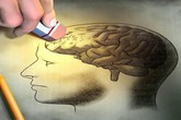 Hãi hùng hình ảnh sán "làm tổ" trong não người đàn ông ở Lào Cai Hãi hùng hình ảnh sán "làm tổ" trong não người đàn ông ở Lào Cai