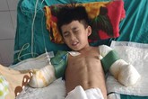 Mất đôi tay, cậu bé 12 tuổi bị điện giật chỉ mong giữ được đôi chân Mất đôi tay, cậu bé 12 tuổi bị điện giật chỉ mong giữ được đôi chân