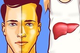 Nếu 4 dấu hiệu này xuất hiện trên mặt thì gan đã bị tổn thương trầm trọng, đừng chần chừ mà hãy đi khám gấp Nếu 4 dấu hiệu này xuất hiện trên mặt thì gan đã bị tổn thương trầm trọng, đừng chần chừ mà hãy đi khám gấp