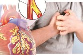 Chị em cần ghi nhớ dấu hiệu bệnh tim mạch nguy hiểm nhất nhiều người mắc Chị em cần ghi nhớ dấu hiệu bệnh tim mạch nguy hiểm nhất nhiều người mắc