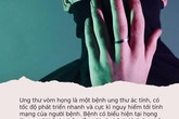 Đặt 3 ngón tay tại vị trí này trên cơ thể, bạn sẽ biết mình có nguy cơ mắc ung thư vòm họng hay không Đặt 3 ngón tay tại vị trí này trên cơ thể, bạn sẽ biết mình có nguy cơ mắc ung thư vòm họng hay không