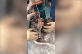 Kinh hãi lá phổi đen kịt của bệnh nhân sau 30 năm hút thuốc, nếu nhìn thấy bạn có còn dám hút thuốc? Kinh hãi lá phổi đen kịt của bệnh nhân sau 30 năm hút thuốc, nếu nhìn thấy bạn có còn dám hút thuốc?