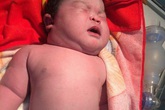 Bé sơ sinh khổng lồ nặng 7,3kg, giờ 36 năm trôi qua nhìn không ai nhận ra Bé sơ sinh khổng lồ nặng 7,3kg, giờ 36 năm trôi qua nhìn không ai nhận ra