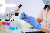 Sau vụ 'cắt đôi que thử HIV' ở BV Xanh Pôn, Bộ Y tế yêu cầu 'siết' quản lý xét nghiệm, quản lý nội bộ Sau vụ 'cắt đôi que thử HIV' ở BV Xanh Pôn, Bộ Y tế yêu cầu 'siết' quản lý xét nghiệm, quản lý nội bộ