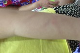 Cô giáo đánh con, phụ huynh thoả thuận bồi thường 19 triệu, sau đòi lên 100 triệu Cô giáo đánh con, phụ huynh thoả thuận bồi thường 19 triệu, sau đòi lên 100 triệu