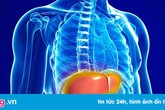 Thủ phạm khiến 50% dân số Việt Nam bị gan nhiễm mỡ Thủ phạm khiến 50% dân số Việt Nam bị gan nhiễm mỡ