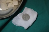 Thêm một trường hợp trẻ bị hóc đồng xu do đùa nghịch Thêm một trường hợp trẻ bị hóc đồng xu do đùa nghịch