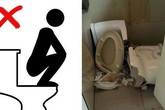 Chàng trai Việt bị rách tầng sinh môn sau khi ngồi xổm lên bồn cầu Chàng trai Việt bị rách tầng sinh môn sau khi ngồi xổm lên bồn cầu