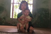 Tâm sự xót đau của cặp vợ chồng khuyết tật giàu nghị lực có con gái nhỏ bị teo mật bẩm sinh Tâm sự xót đau của cặp vợ chồng khuyết tật giàu nghị lực có con gái nhỏ bị teo mật bẩm sinh
