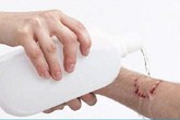 5 sự thật cần biết về bệnh dại 5 sự thật cần biết về bệnh dại