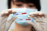 10 người nghi bị phơi nhiễm HIV do người lạ đâm: Bác sĩ khuyến cáo không nên quá hoảng hốt 10 người nghi bị phơi nhiễm HIV do người lạ đâm: Bác sĩ khuyến cáo không nên quá hoảng hốt