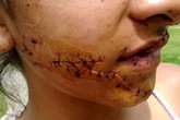 Đắk Lắk: Rạch mặt người tình vì nhớ lại chuyện bị "cắm sừng" Đắk Lắk: Rạch mặt người tình vì nhớ lại chuyện bị "cắm sừng"